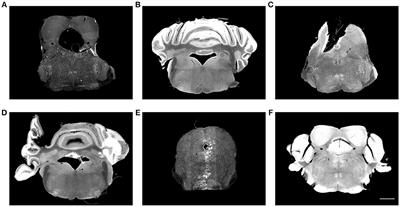 Mapping Histological Slice Sequences to the Allen Mouse <mark class="highlighted">Brain Atlas</mark> Without 3D Reconstruction